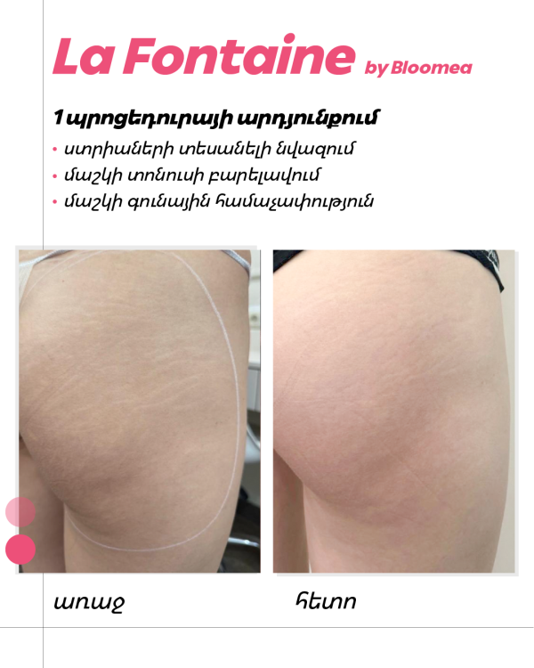 Artboard 1 copy 2 (11)